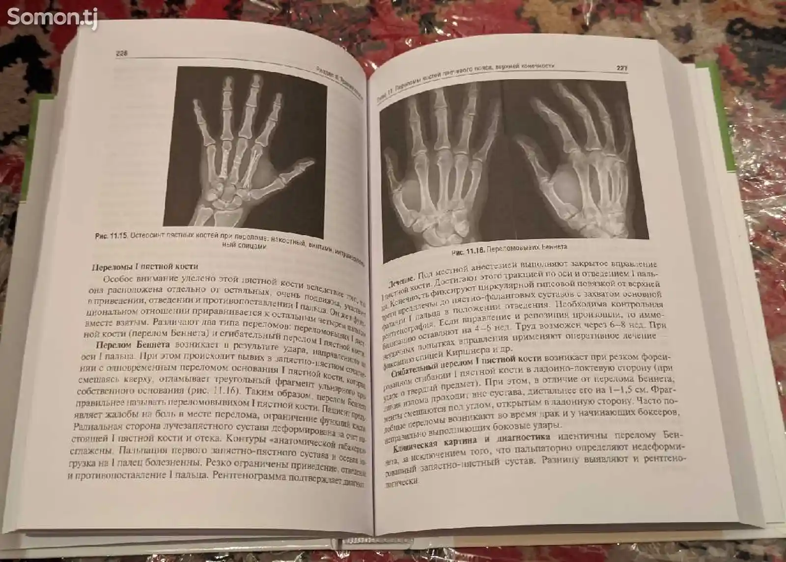 Книга Травматология и ортопедия-6