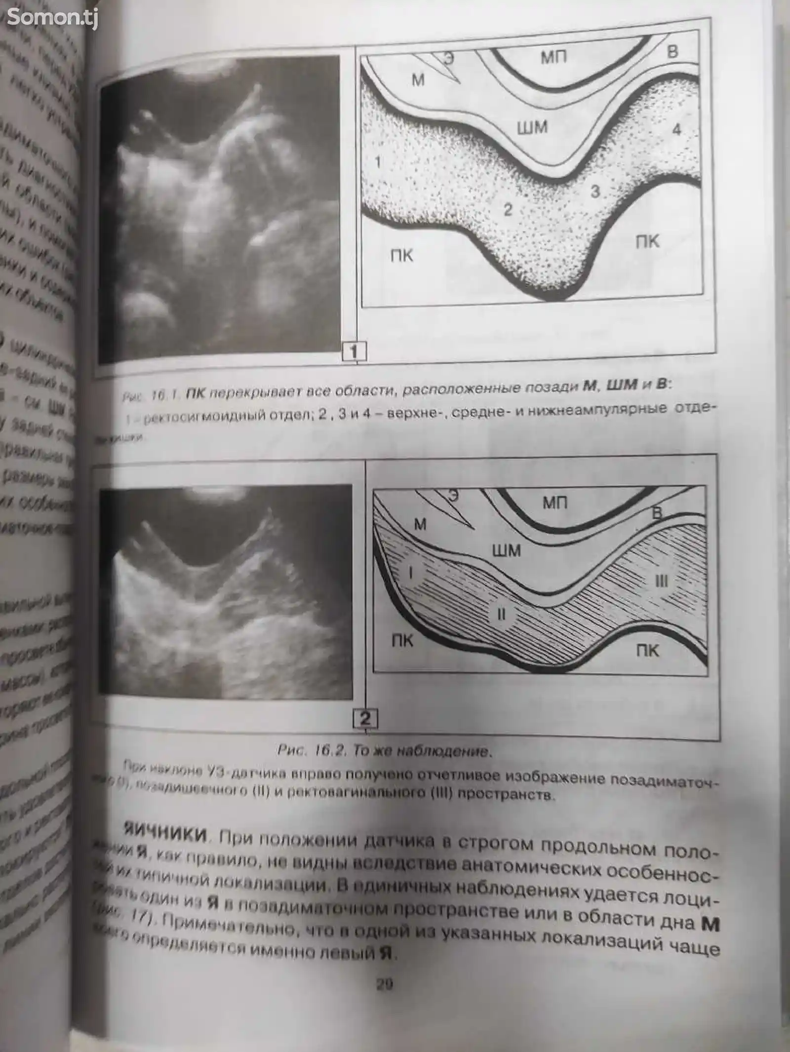 Книга УЗИ в гинекологии-3