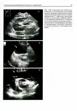 Ультразвуковое исследование в урологии и неврологии-9
