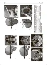 Книга оториноларингология-15