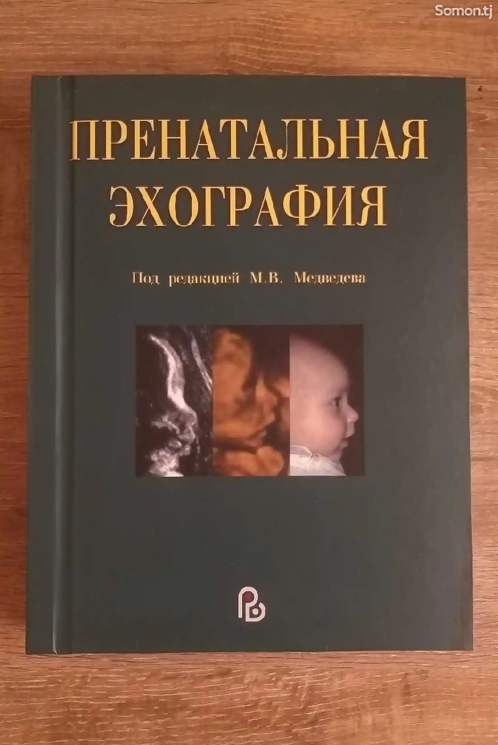 Книга Пренатальная эхо-графия-1