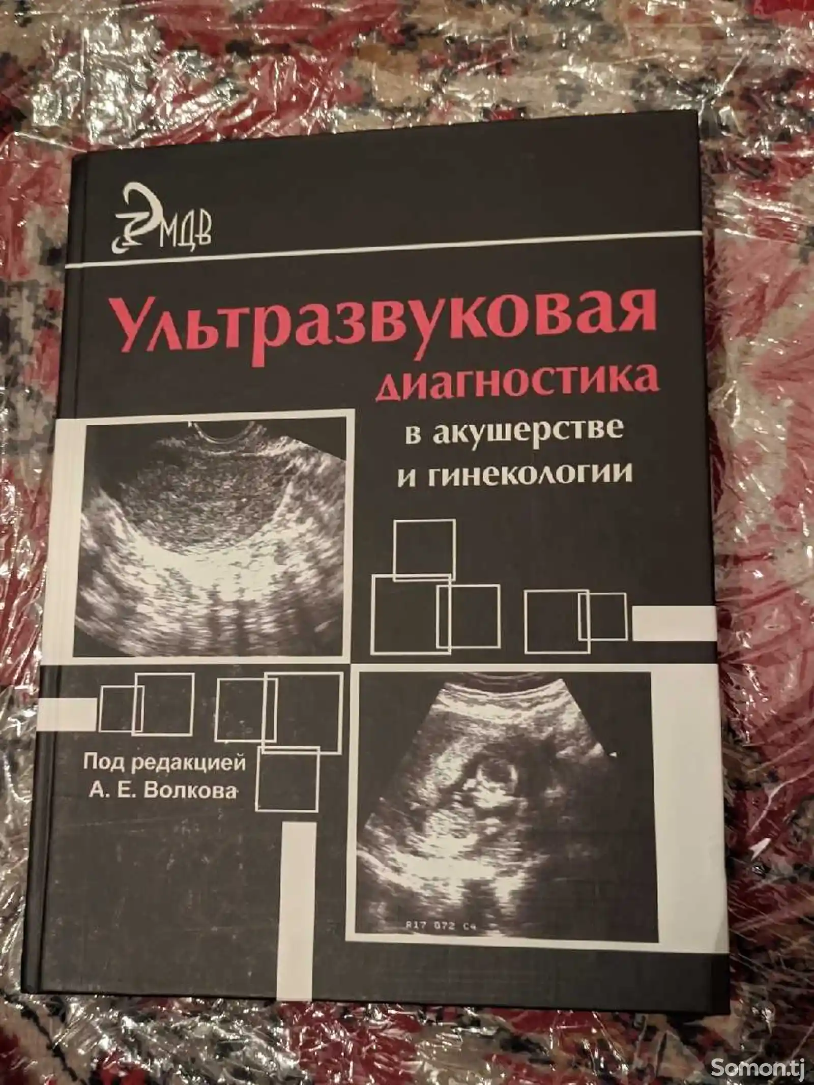 Книга Ультразвуковая диагностика в акушерстве и гинекологии-1