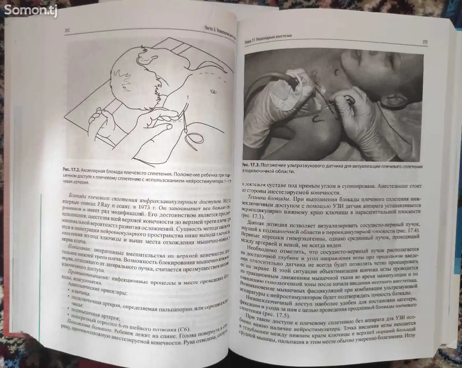 Книга анестезия в детской практике-8
