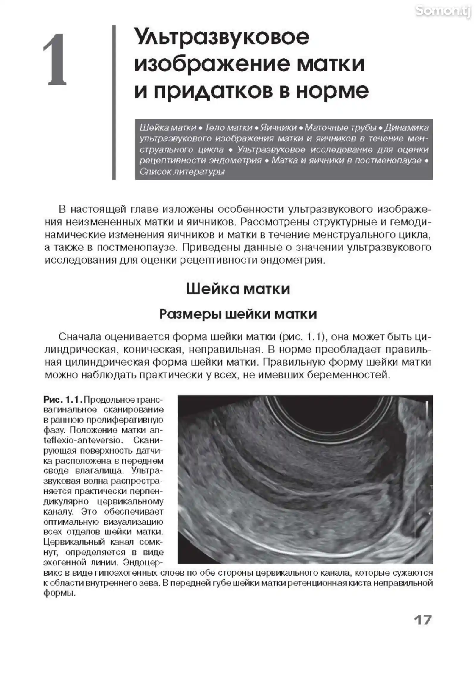 Книга Ультразвуковая диагностика в гинекологии-7