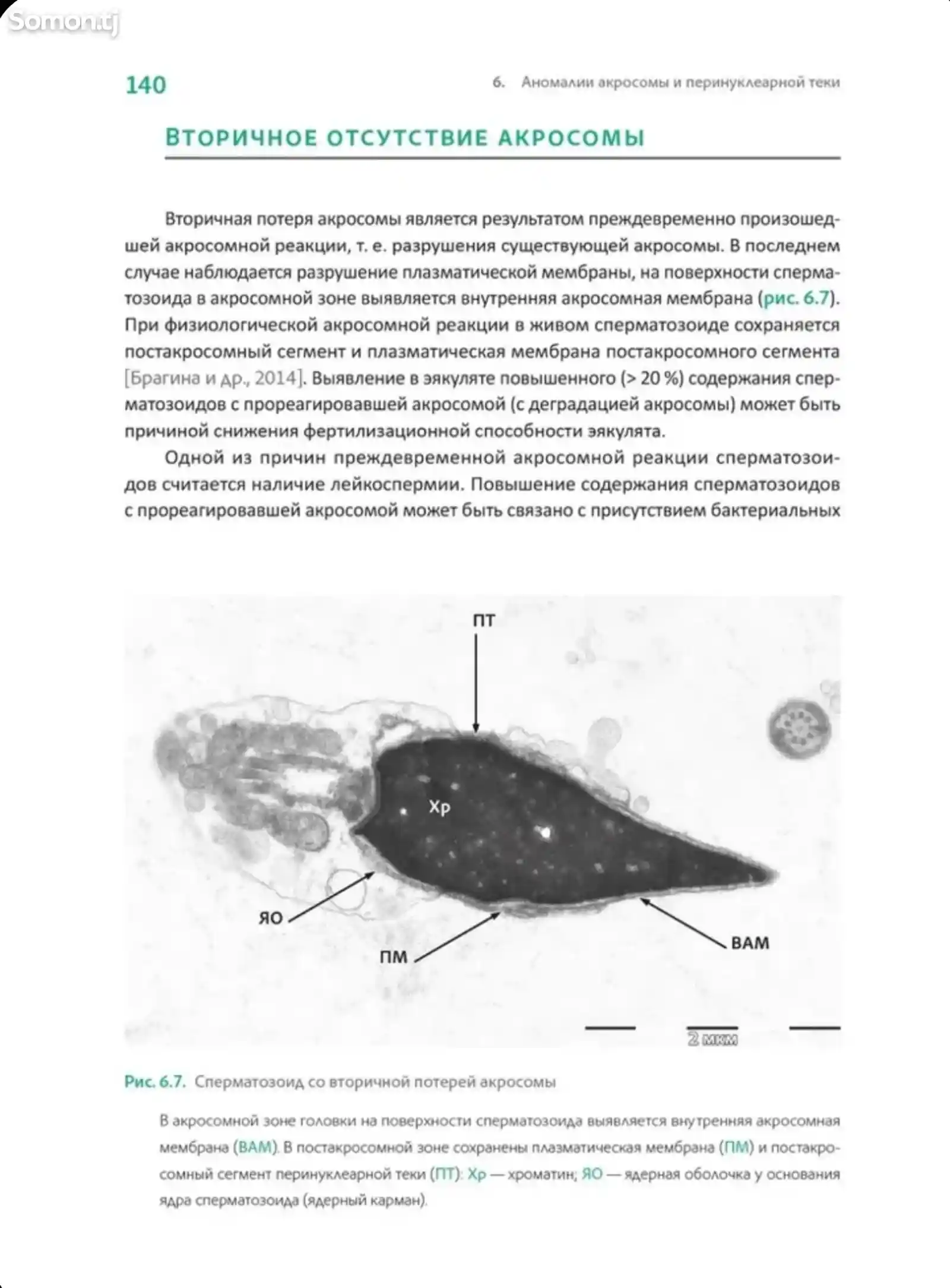 Книга Интерпретация спермограммы-10