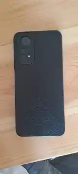 Xiaomi Redmi Note 11-4