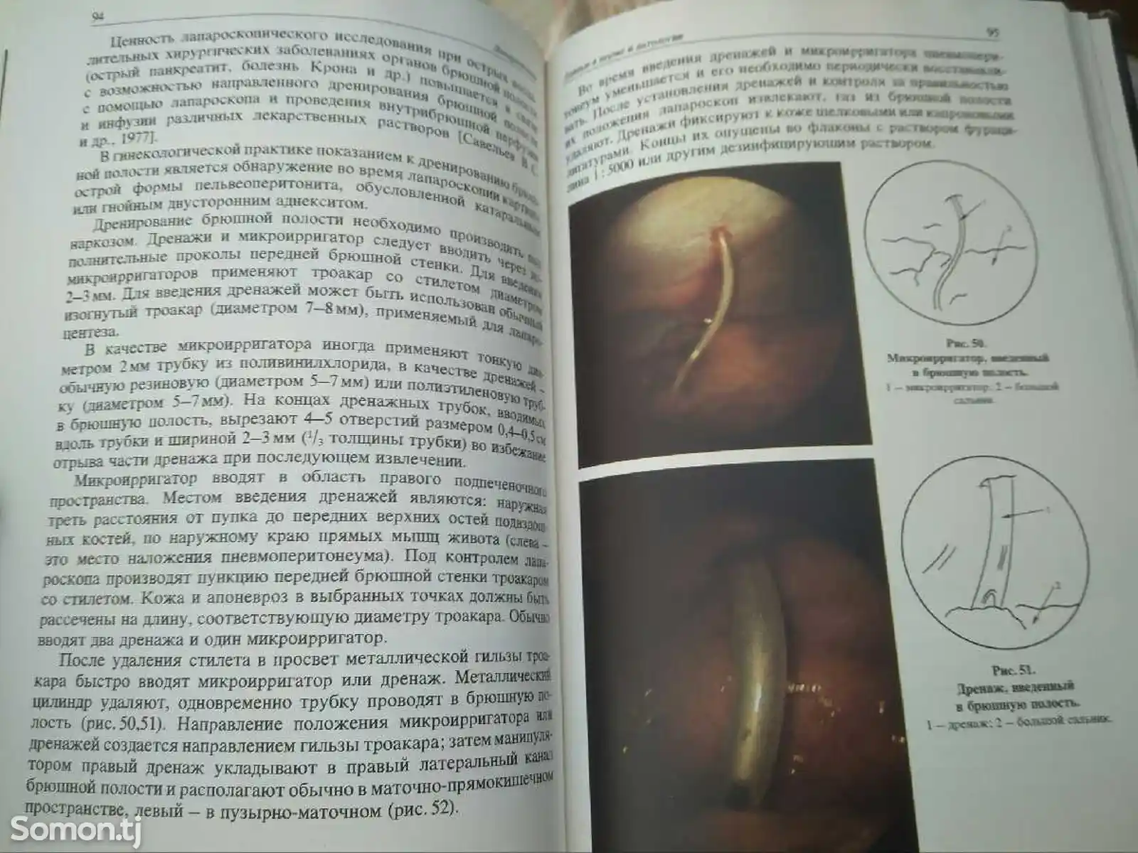 Книга - Эндоскопия в гинекологии-4