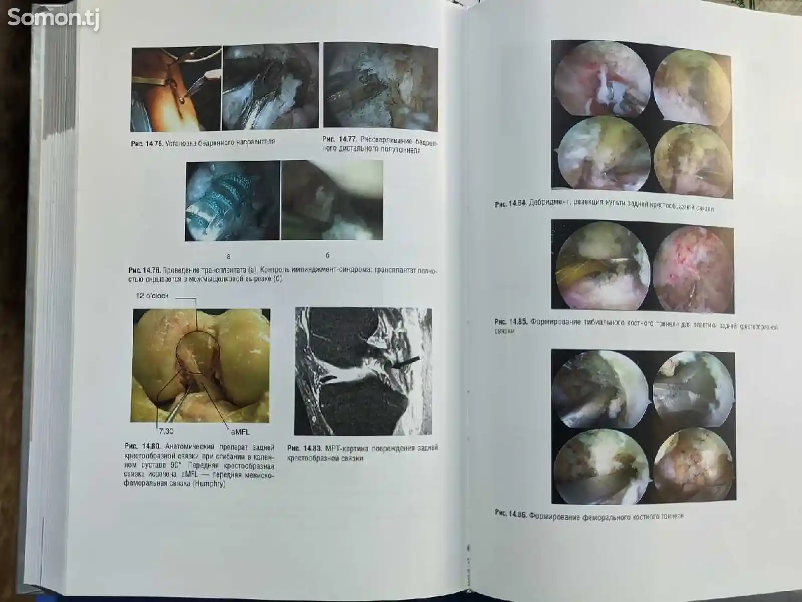 Книга Травматология-10