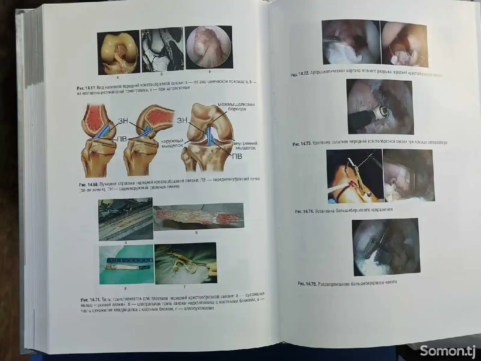 Книга Травматология-11
