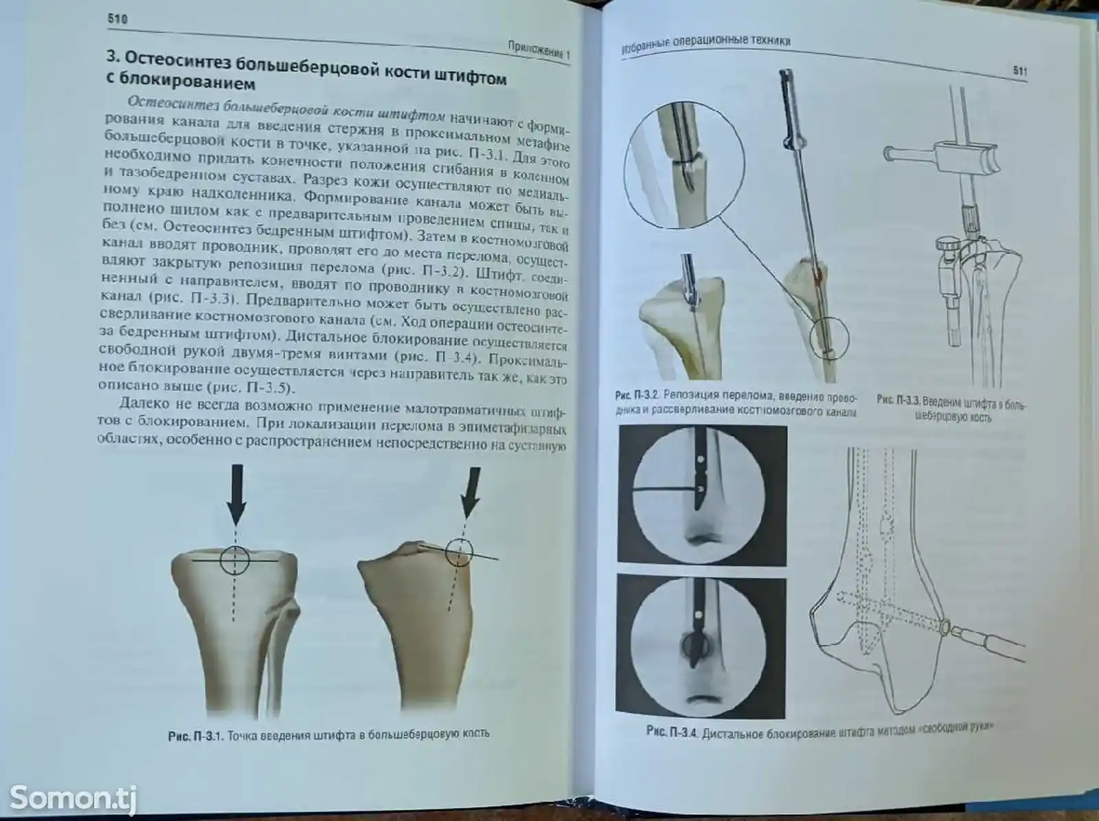 Книга-травматология и ортопедия-9