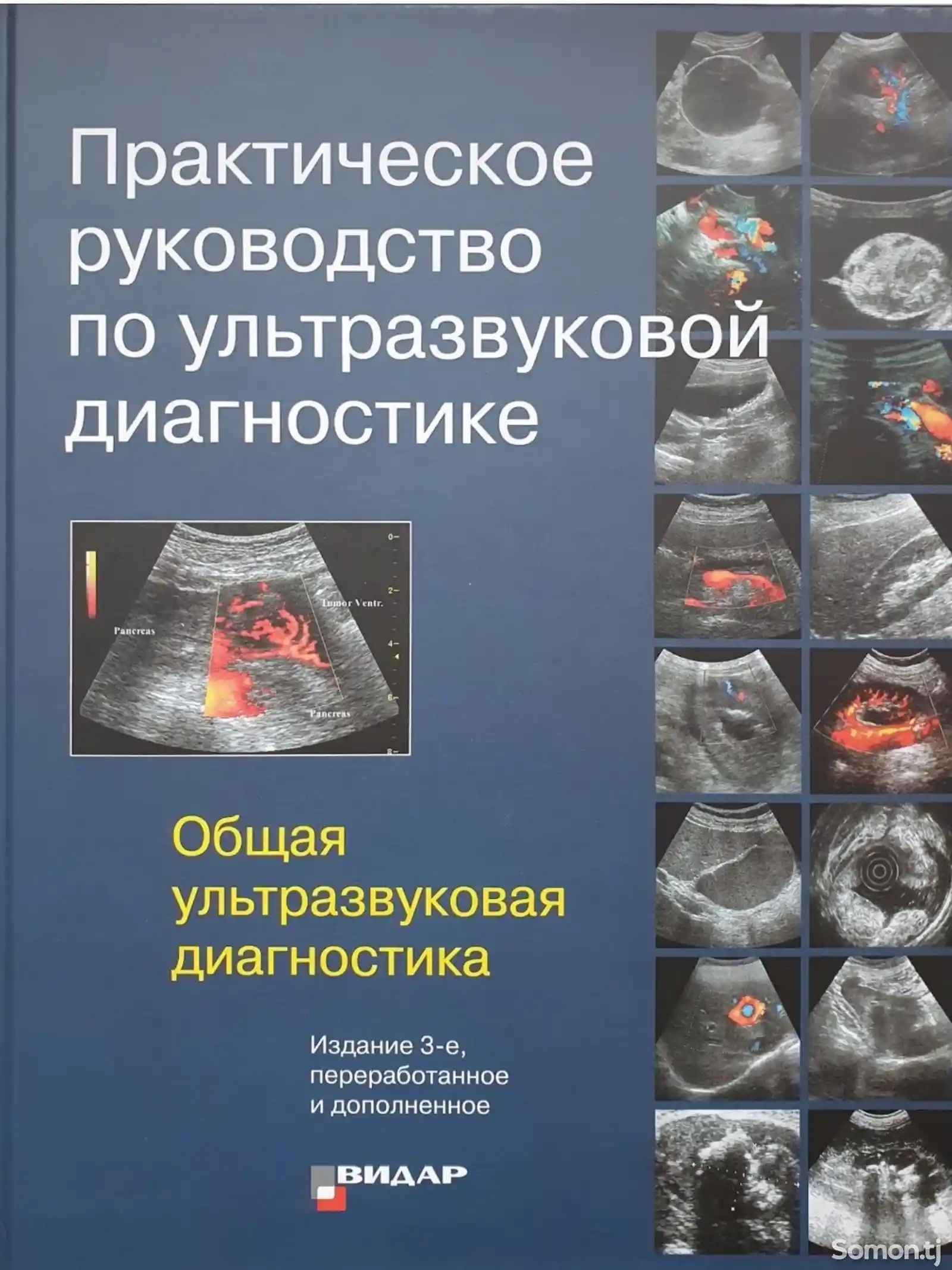 Книга Руководство по ультразвуковой диагностике на заказ-1