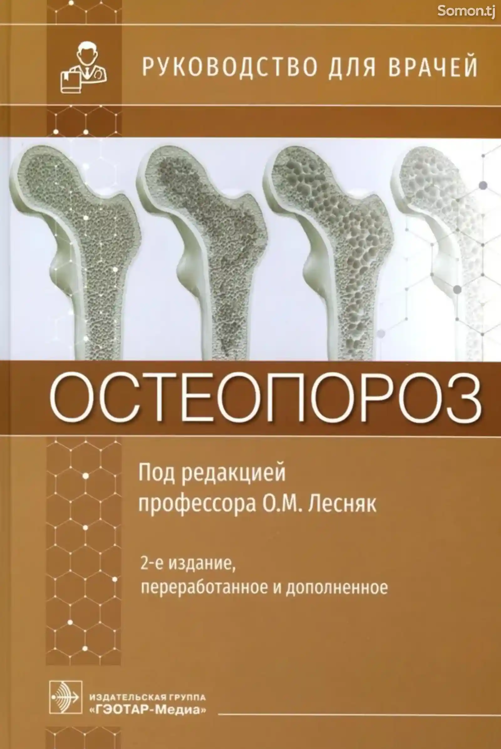 Книга Остеопороз-1